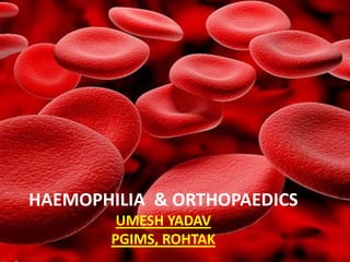 HAEMOPHILIA & ORTHOPAEDICS
UMESH YADAV
PGIMS, ROHTAK
 
