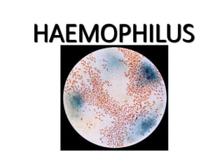 HAEMOPHILUS
1
 