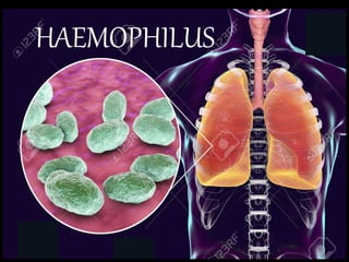 Haemophilus species | PPT
