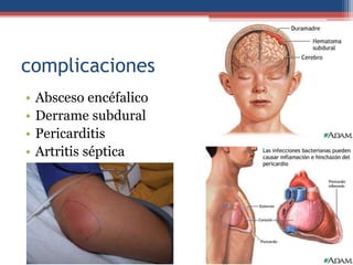 complicaciones
•
•
•
•

Absceso encéfalico
Derrame subdural
Pericarditis
Artritis séptica

 