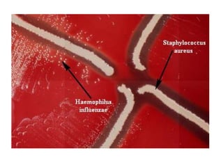 Diagnóstico
• Cultivo
• Aglutinación de partículas de látex (prueba
antigénica)
• PCR
 