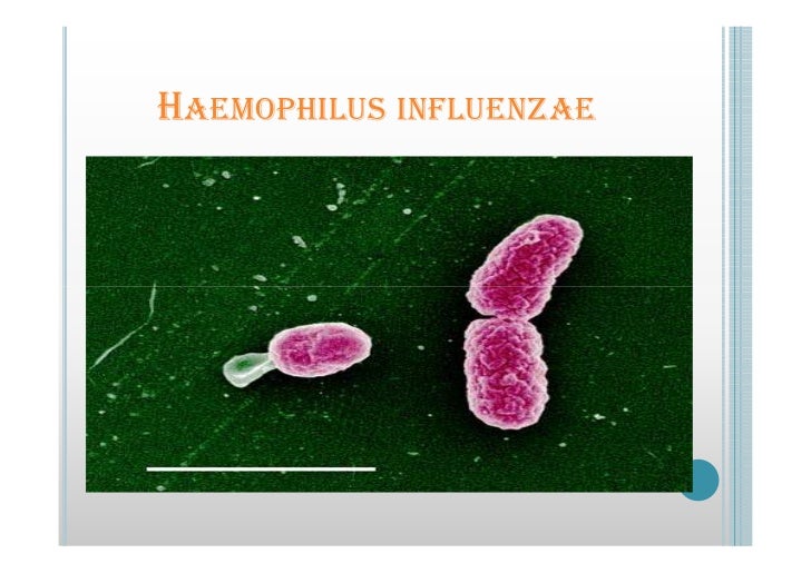 haemophilus influenzae