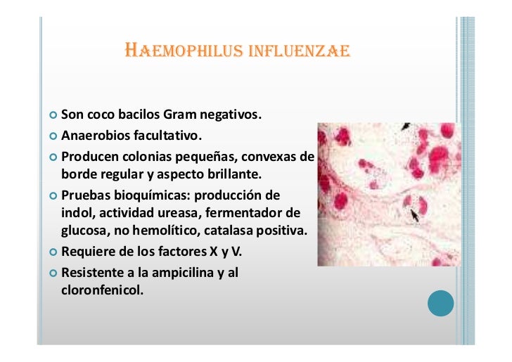 haemophilus influenzae