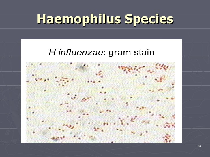 Haemophilus species