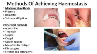Methods Of Achieving Haemostasis
1.Mechanical methods
• Pressure
• Hemostat
• Suture and ligation
2.Chemical methods
• Adrenaline
• Thrombin
• Surgicel
• Oxygel
• Gelatin sponge
• Microfibrillar collagen
• Fibrous glue
• Styptics and astringents
 