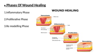 • Phases Of Wound Healing
1.Inflammatory Phase
2.Proliferative Phase
3.Re modelling Phase
 