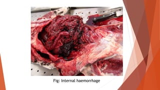 Fig: Internal haemorrhage
 
