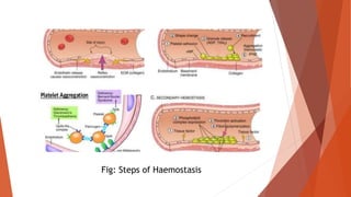 Fig: Steps of Haemostasis
 