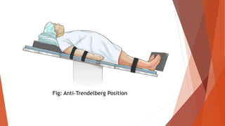 Fig: Anti-Trendelberg Position
 