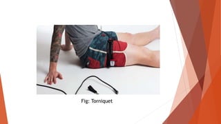 Fig: Torniquet
 
