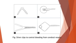 Fig: Silver clips to control bleeding from cerebral vessels
 