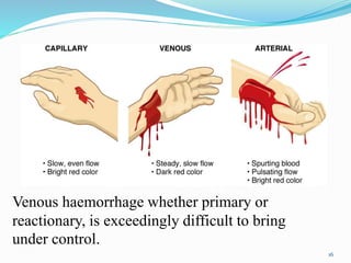 16
Venous haemorrhage whether primary or
reactionary, is exceedingly difficult to bring
under control.
 