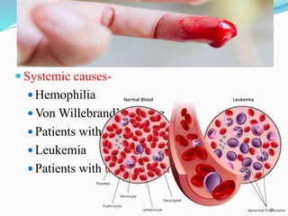  Systemic causes-
 Hemophilia
 Von Willebrand’s disease
 Patients with thrombocytopenia
 Leukemia
 Patients with uncontrolled hypertension.
32
 