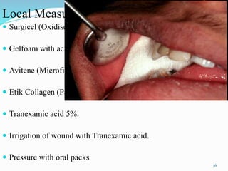 Local Measures ( Synthetic Materials)
 Surgicel (Oxidised RegeneratedCellulose)
 Gelfoam with activated thrombin.
 Avitene (Microfibrillar Collagen).
 Etik Collagen (Packed collagen).
 Tranexamic acid 5%.
 Irrigation of wound with Tranexamic acid.
 Pressure with oral packs
36
 