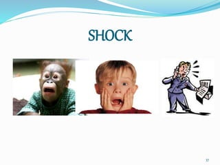 SHOCK
37
 