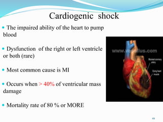  The impaired ability of the heart to pump
blood
 Dysfunction of the right or left ventricle
or both (rare)
 Most common cause is MI
 Occurs when > 40% of ventricular mass
damage
 Mortality rate of 80 % or MORE
49
Cardiogenic shock
 