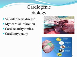 Cardiogenic
etiology
 Valvular heart disease
 Myocardial infarction.
 Cardiac arrhythmias.
 Cardiomyopathy
50
 