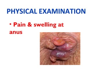 PHYSICAL EXAMINATION
• Pain & swelling at
anus
 