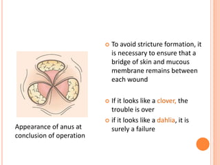  To avoid stricture formation, it
is necessary to ensure that a
bridge of skin and mucous
membrane remains between
each wound
 If it looks like a clover, the
trouble is over
 if it looks like a dahlia, it is
surely a failureAppearance of anus at
conclusion of operation
 