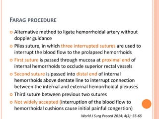 FARAG PROCEDURE
 Alternative method to ligate hemorrhoidal artery without
doppler guidance
 Piles suture, in which three interrupted sutures are used to
interrupt the blood flow to the prolapsed hemorrhoids
 First suture is passed through mucosa at proximal end of
internal hemorrhoids to occlude superior rectal vessels
 Second suture is passed into distal end of internal
hemorrhoids above dentate line to interrupt connection
between the internal and external hemorrhoidal plexuses
 Third suture between previous two sutures
 Not widely accepted (interruption of the blood flow to
hemorrhoidal cushions cause initial painful congestion)
World J Surg Proced 2014; 4(3): 55-65
 