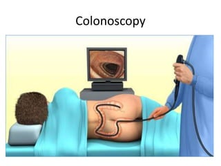Colonoscopy
 