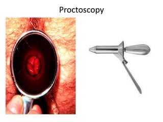 Proctoscopy
 