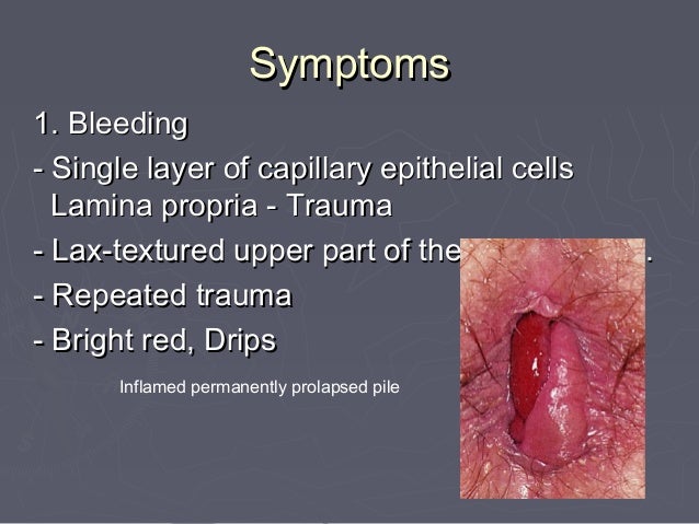 Haemorrhoids- Dr. Vijayalakshmi