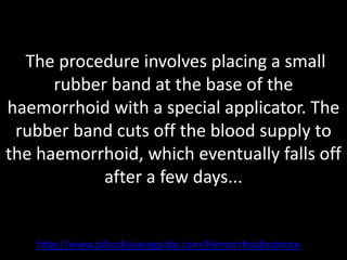 The procedure involves placing a small
      rubber band at the base of the
haemorrhoid with a special applicator. The
 rubber band cuts off the blood supply to
the haemorrhoid, which eventually falls off
            after a few days...


    http://www.pilesdiseaseguide.com/Hemorrhoidnomore
 