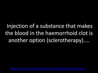 Injection of a substance that makes
the blood in the haemorrhoid clot is
  another option (sclerotherapy)....



  http://www.pilesdiseaseguide.com/Hemorrhoidnomore
 