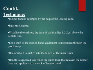 Contd..
Technique:
•Rubber band is equipped by the help of the loading cone.
•Pass proctoscope.
•Visualize the cushion, the base of cushion lies 1.5-2cm above the
dentate line.
•Long shaft of the suction band equipment is introduced through the
proctoscope.
•Haemorrhoid is sucked into the lumen of the inner drum.
•Handle is squeezed toadvance the outer drum that releases the rubber
band and applies it to the neck of haemorrhoid.
 