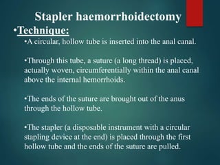 Stapler haemorrhoidectomy
•Technique:
•A circular, hollow tube is inserted into the anal canal.
•Through this tube, a suture (a long thread) is placed,
actually woven, circumferentially within the anal canal
above the internal hemorrhoids.
•The ends of the suture are brought out of the anus
through the hollow tube.
•The stapler (a disposable instrument with a circular
stapling device at the end) is placed through the first
hollow tube and the ends of the suture are pulled.
 
