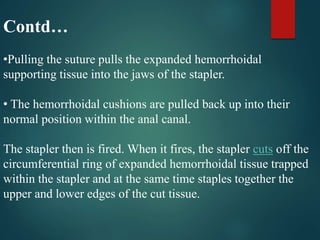 Contd…
•Pulling the suture pulls the expanded hemorrhoidal
supporting tissue into the jaws of the stapler.
• The hemorrhoidal cushions are pulled back up into their
normal position within the anal canal.
The stapler then is fired. When it fires, the stapler cuts off the
circumferential ring of expanded hemorrhoidal tissue trapped
within the stapler and at the same time staples together the
upper and lower edges of the cut tissue.
 