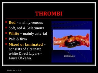 THROMBI
 Red - mainly venous
 Soft, red & Gelatinous
 White – mainly arterial
 Pale & firm
 Mixed or laminated –
cons...