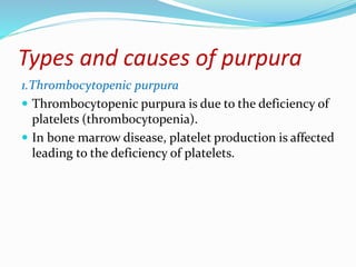 Types and causes of purpura
1.Thrombocytopenic purpura
 Thrombocytopenic purpura is due to the deficiency of
platelets (thrombocytopenia).
 In bone marrow disease, platelet production is affected
leading to the deficiency of platelets.
 