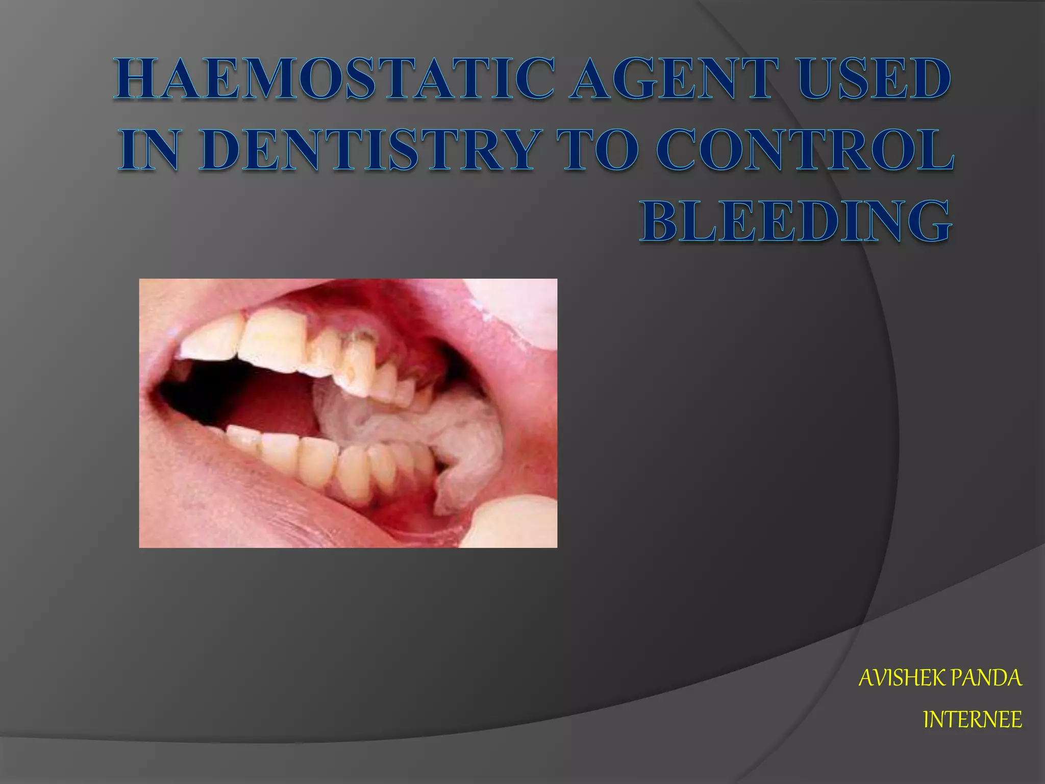 Haemostatic agent used in dentistry to control bleeding PPT