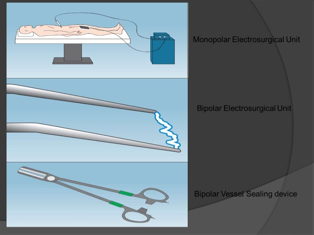 Haemostatic agent used in dentistry to control bleeding