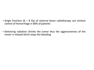 Hemostatic Radiotherapy
• Single fractions (6 – 8 Gy) of external beam radiotherapy can achieve
control of hemorrhage in 80% of patients
• Delivering radiation shrinks the tumor thus the aggressiveness of the
tumor is relaxed which stops the bleeding