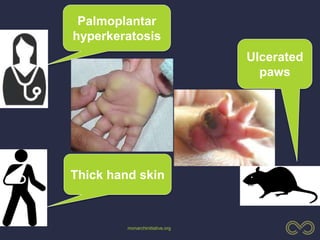 monarchinitiative.org
Ulcerated
paws
Palmoplantar
hyperkeratosis
Thick hand skin
 