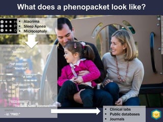 What does a phenopacket look like?
 Alacrima
 Sleep Apnea
 Microcephaly
phenotype_profile:
- entity: ”patient16"
phenot...