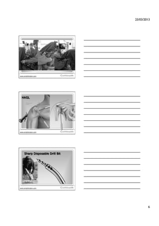 23/03/2013!




                                  16
www.wrightington.com




  HAGL




                                  17
www.wrightington.com




     Sharp Disposable Drill Bit




                                  18
www.wrightington.com




                                                6!
 