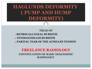 HAGLUNDS DEFORMITY
  ( PUMP AND HUMP
     DEFORMITY)

                TRIAD OF
1.RETROCALCANEAL BURSITIS
2.TENDOACHILLES BURSITIS
3.PARTIAL TEAR OF THE ACHILLES TENDON



    FREELANCE RADIOLOGY
  CONTINUATION OF BASIC DIAGNOSTIC
            RADIOLOGY
 