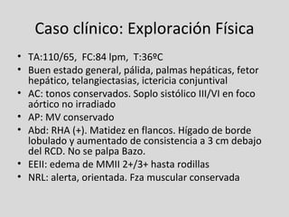 Caso clínico: Exploración Física TA:110/65,  FC:84 lpm,  T:36ºC Buen estado general, pálida, palmas hepáticas, fetor hepático, telangiectasias, ictericia conjuntival AC: tonos conservados. Soplo sistólico III/VI en foco aórtico no irradiado AP: MV conservado Abd: RHA (+). Matidez en flancos. Hígado de borde lobulado y aumentado de consistencia a 3 cm debajo del RCD. No se palpa Bazo. EEII: edema de MMII 2+/3+ hasta rodillas NRL: alerta, orientada. Fza muscular conservada 