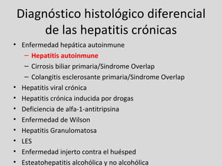 Diagnóstico histológico diferencial de las hepatitis crónicas <ul><li>Enfermedad hepática autoinmune </li></ul><ul><ul><li...