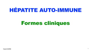 Claude EUGÈNE
HÉPATITE AUTO-IMMUNE
Formes cliniques
12
 