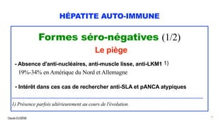 Claude EUGÈNE
HÉPATITE AUTO-IMMUNE
Formes séro-négatives (1/2)
Le piège
- Absence d'anti-nucléaires, anti-muscle lisse, anti-LKM1 1)
19%-34% en Amérique du Nord et Allemagne
- Intérêt dans ces cas de rechercher anti-SLA et pANCA atypiques
............................................................................................................................................
1) Présence parfois ultérieurement au cours de l'évolution.
19
 