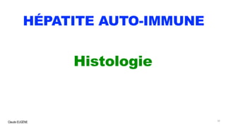 Claude EUGÈNE
HÉPATITE AUTO-IMMUNE
Histologie
32
 