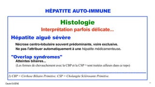 Claude EUGÈNE
HÉPATITE AUTO-IMMUNE
Histologie
Interprétation parfois délicate...
Hépatite aiguë sévère
Nécrose centro-lobulaire souvent prédominante, voire exclusive.
Ne pas l'attribuer automatiquement à une hépatite médicamenteuse.
"Overlap syndromes"
Atteintes biliaires...
(Les formes de chevauchement avec la CBP et la CSP 1) sont traitées ailleurs dans ce topo)
....................................................................................................................................
1) CBP = Cirrhose Biliaire Primitive; CSP = Cholangite Sclérosante Primitive.
34
 