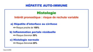 Claude EUGÈNE
HÉPATITE AUTO-IMMUNE
Histologie
Intérêt pronostique : risque de rechute variable
a) Hépatite d'interface ou cirrhose
=> Risque proche de 100%
b) Inflammation portale résiduelle
=> Risque d'environ 50%
c) Histologie normale
=> Risque d'environ 20%
35
 