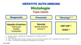 Claude EUGÈNE
HÉPATITE AUTO-IMMUNE
Histologie
Triple intérêt
36
Diagnostic Pronostic "Overlap" 1)
Hépatite d'interface
Plasmocytes
Rosettes
Emperipolèse
Sévérité
Nécrose extensive
Cirrhose 2)
CBP CSP 3)
NASH 4)
1) Overlap syndrome = Syndrome de chevauchement avec la CBP ou la CSP 3)
2) 25-30% des cas
3) CBP = Cholangite Biliaire Primitive (appelée avant cirrhose biliaire primitive), CSP = Cholangite Sclérosante Primitive.
4) NASH = Non Alcoholic SteatoHepatitis (stéatohépatite non alcoolique).
 