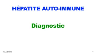 Claude EUGÈNE
HÉPATITE AUTO-IMMUNE
Diagnostic
37
 